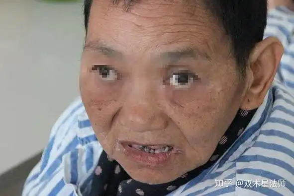 为什么要远离精神病患者?