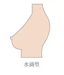 现在总结一下吧,从胸盘形状上看大部份胸都属于圆形胸盘——圆盘胸