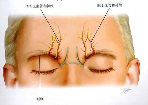1 颞部标红区)图 1 面部注射危险区(标红区)了解面部注射并发症高危区