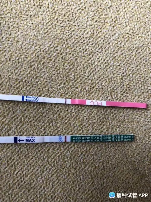 [试管婴儿]4aa囊胚第七天,大卫只有灰印