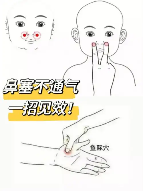 宝宝鼻塞不通气一招快速见效60