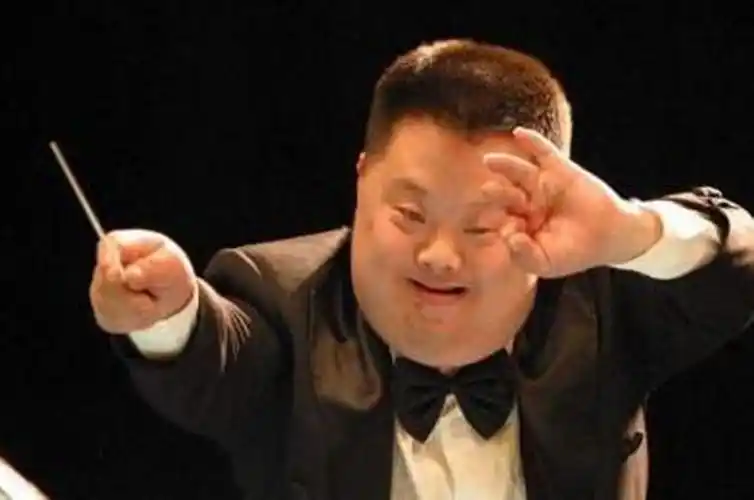 唐氏综合症特征图片_有来医生