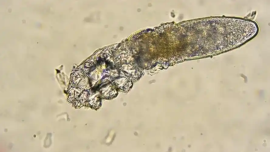 脸上的螨虫是怎么样的?100倍显微镜下的螨虫是这样的!