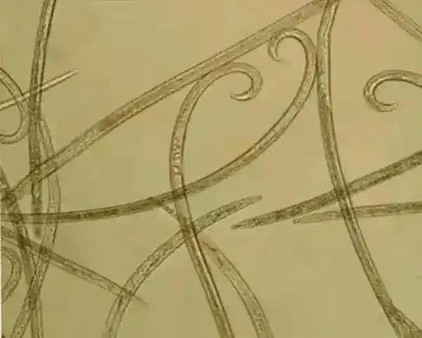 松材线虫(pine wood nematode)是一种植物寄生线虫,属蠕形动物门,线虫