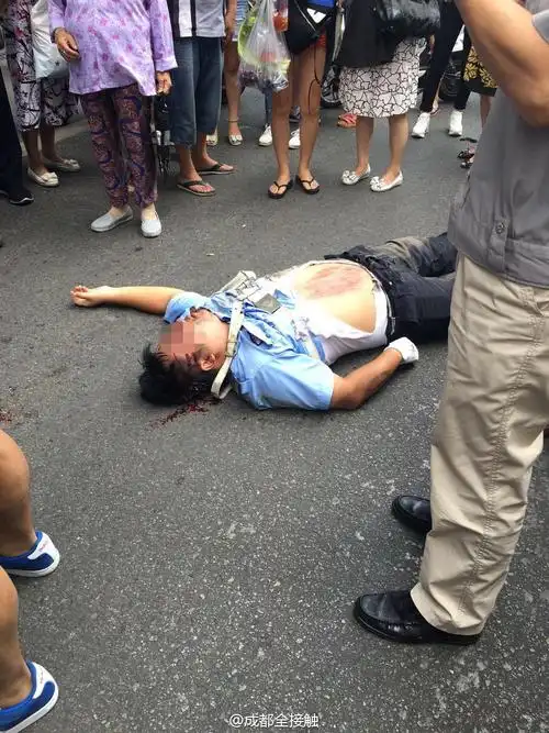 协警被撞倒遭碾压现场图片显示头部流血腹部大面积擦痕