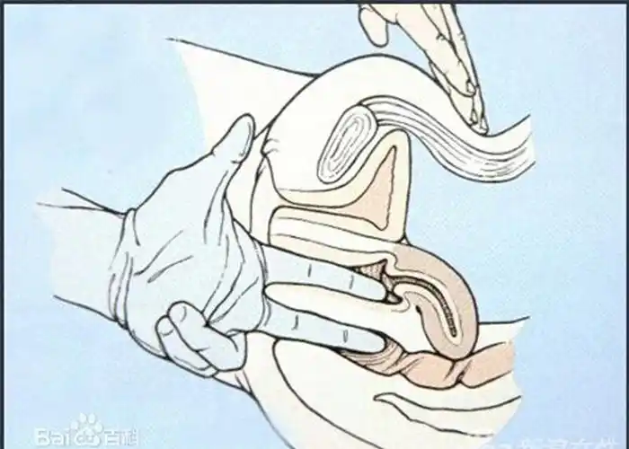 妇科b超检查二三问