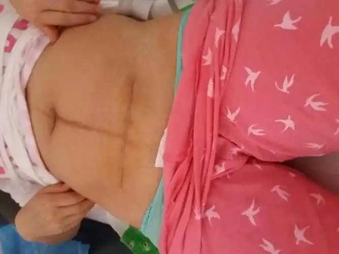 热 晒晒你们的刨妇产伤口