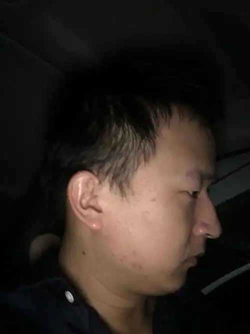 面相,我这样是不是山根断,鼻歪斜