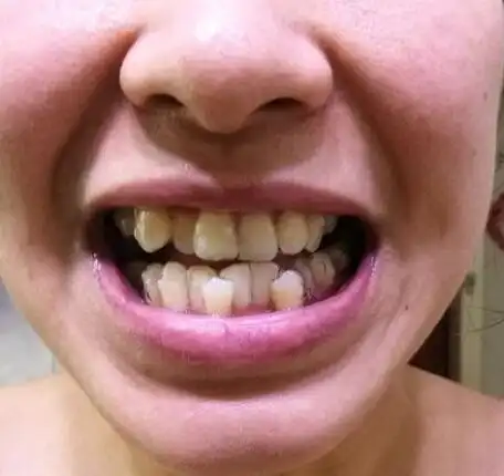 总是被拒绝不受人待见的延吉龅牙女是如何逆袭的