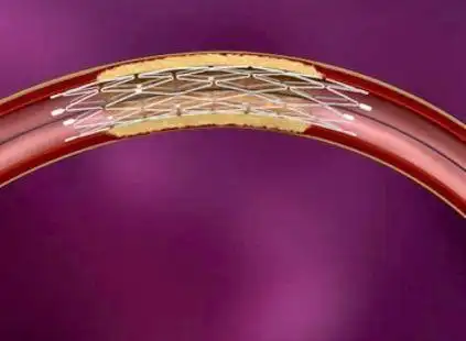 山东省中医院脑病三科(脑血管病科)病房今日开诊