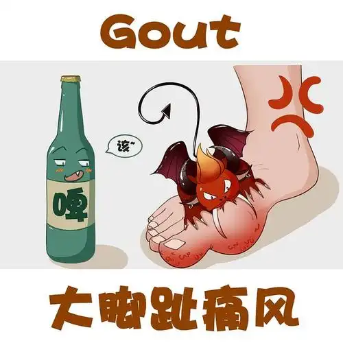 痛风痛风症状什么是痛风痛风不能吃什么痛风图片大脚趾