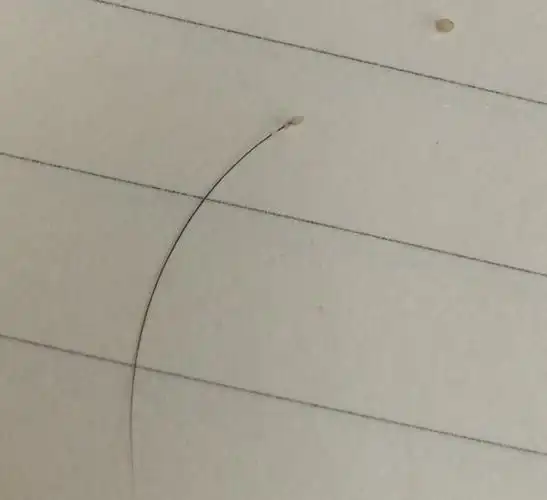 掉下来的头发发根这样是不是没救了