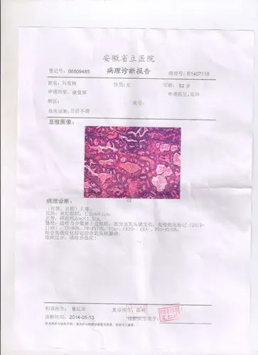 关于子宫方面的病理检测报告,帮我看看谢谢