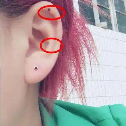 耳朵里有痣(耳朵里有痣代表什么意思)