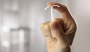 曼月乐环是什么带你揭开它的面纱