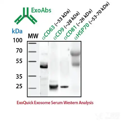另外我看abcam抗体做出来就是26kd左右,不明白啥道理~求教