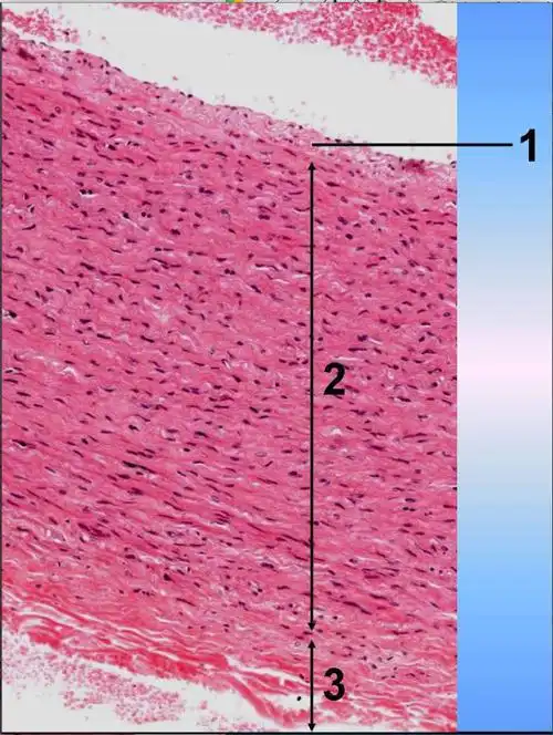 中动脉光镜像,请判断图中2所示的是何种结构?()