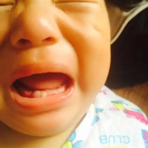 宝宝牙龈红肿九个月了,怎么回事请问一下