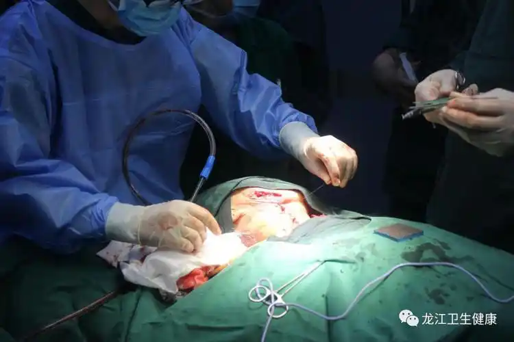 庆安县人民医院为91岁高龄患者施行"巨大甲状腺肿"全切手术获得成功