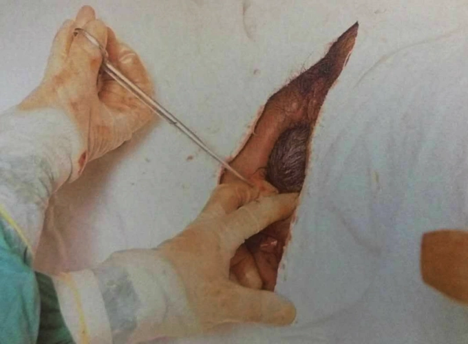 孕妇生孩子全过程真人图