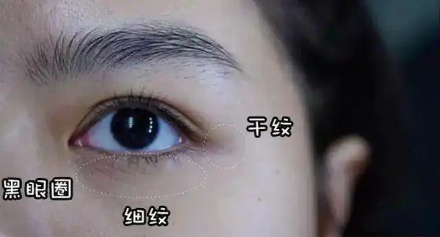 马应龙这波操作,干纹,细纹,鱼尾纹.一网打尽!