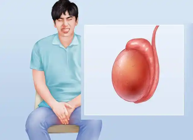 1,婚后生育半年没有排精,老公引起附睾睾丸炎?