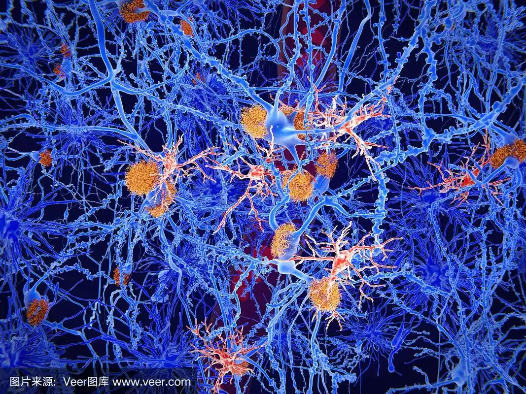 小胶质细胞(红色)在阿尔茨海默病的发病机制中起着重要作用
