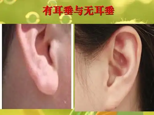 有耳垂与无耳垂 努力才能成功