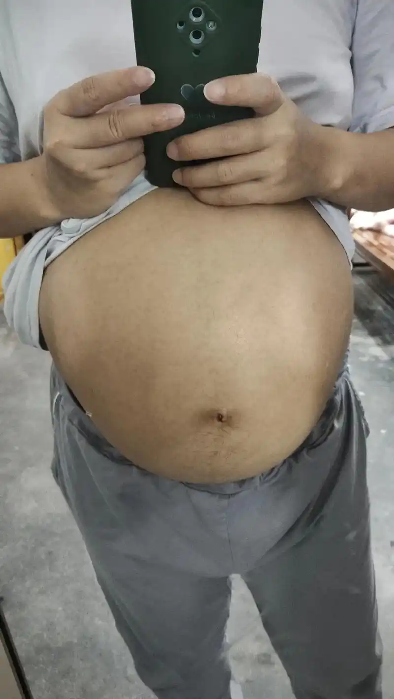 卸货倒计时,前壁下怀,3个月b超女儿,肚子长毛,脸上正常,长 - 抖音