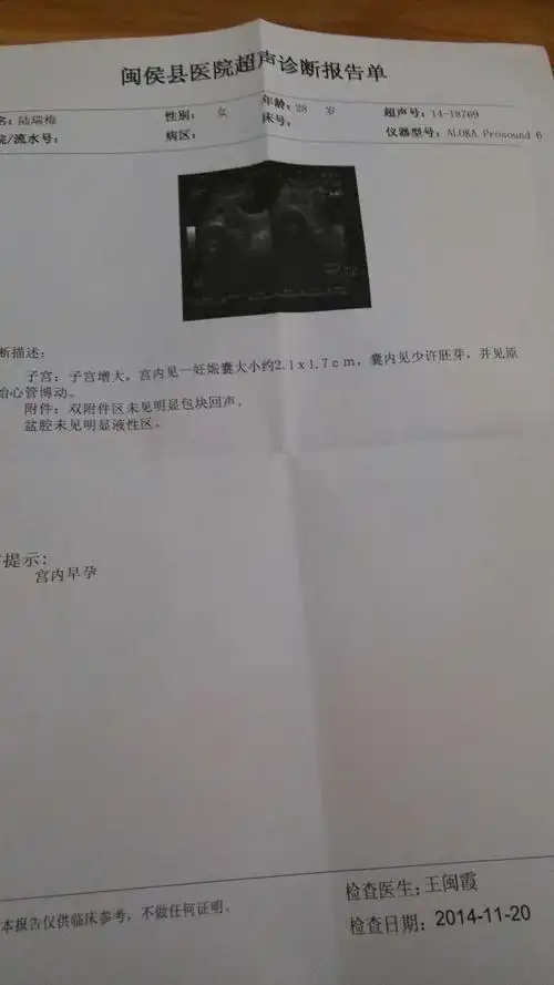 孕40天今天照的b超单.