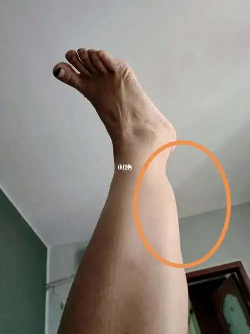 肌肉腿  #瘦小腿肌肉