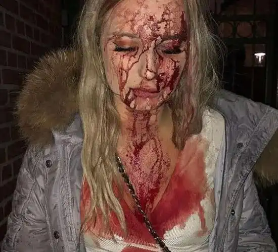 漂亮女孩夜店被骚扰,出手制止反被打得头破血流