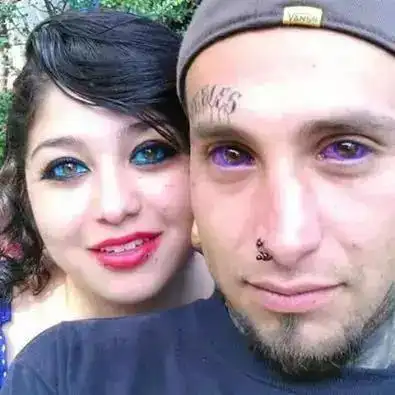 恐怖的眼球纹身图片,在眼白注射颜料,胆小勿入