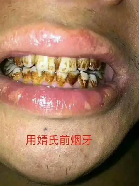 小孩子不喜欢用牙膏刷牙怎么办小朋友不喜欢用牙膏刷牙怎么办