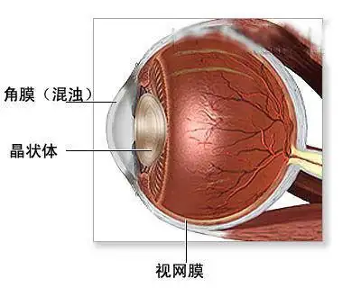 角膜