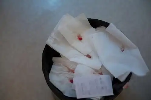 二,咳嗽,咳血这样的胸部不适,常与中央型肺癌侵犯纵隔或累及血管,支