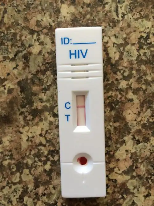 hiv试纸检测过程怎么和其他人不一样?