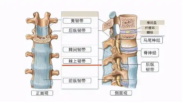 骨科医生:长期腰背痛,警惕"棘上韧带炎"