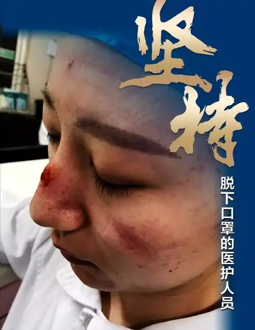 催人泪下抗击疫情英雄的图片!致敬生命守护神～白衣天使!