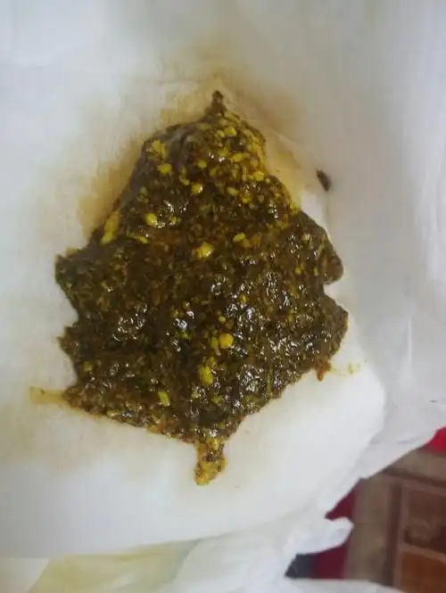 宝宝3个月  混合喂养 今天拉了三次大便 都是这个颜色  正常嘛  好