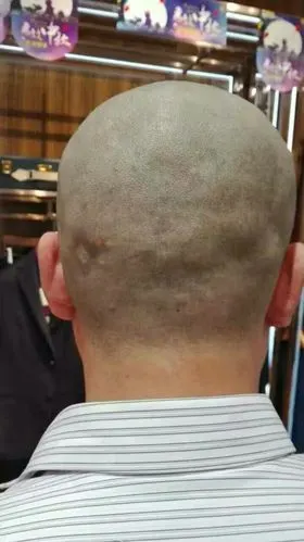 昨天当理发师给她理完发后看到她后脑勺凹凸不平吓了一跳!