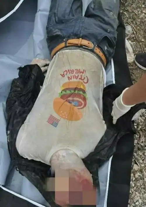 5cm,头面部腐败严重呈"巨人观", 衣着完整,尸体无明显外