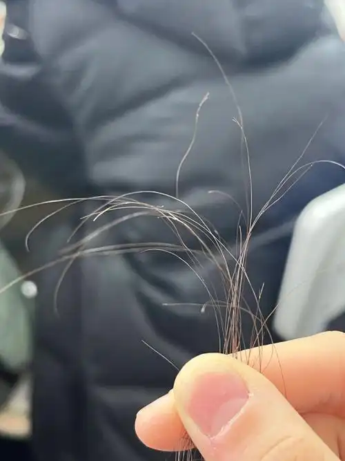 谁来救救我的头发干枯毛躁分叉