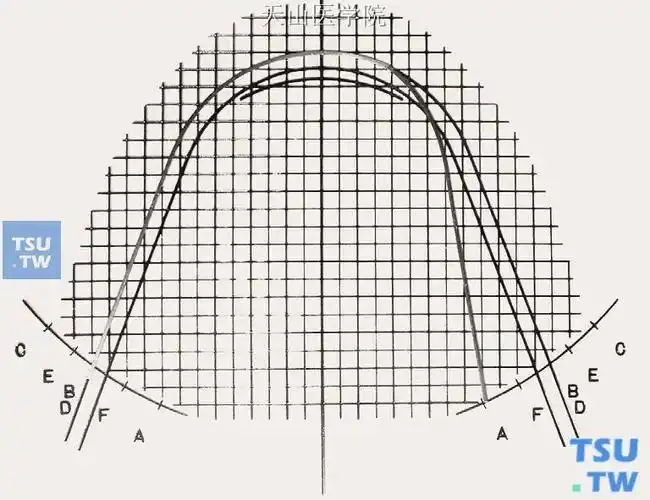 高清图解方形正畸弓丝弯制第一序列弯曲,建议收藏!