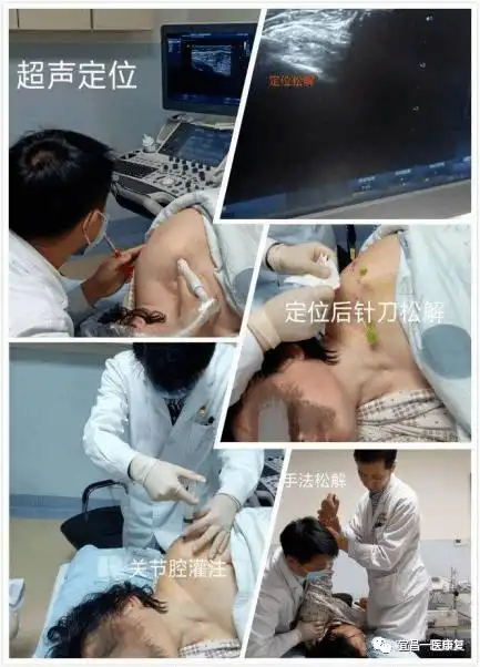 远离肩部疼痛烦恼,学习更多肩部知识_肩关节
