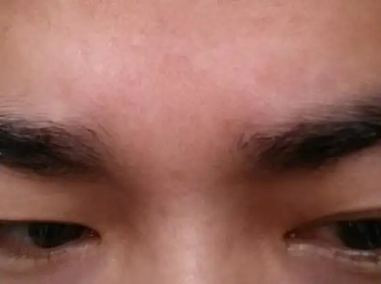 我这是印堂发黑?