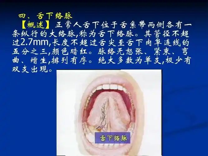 其管径不超 过2.7mm,长度不超过舌尖至舌下肉阜连线的 五分之