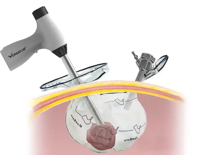 医疗产品,手术刀,腹腔手术刀,内脏切割刀