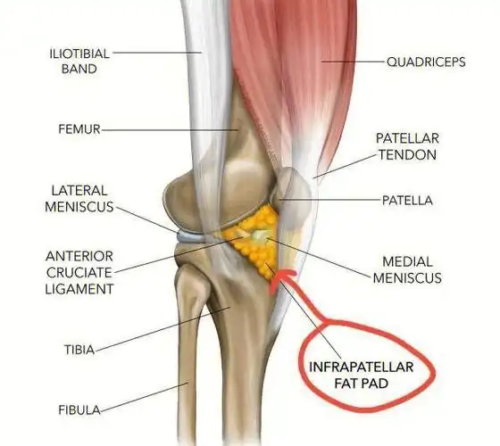髌下脂肪垫发炎为什么会引起腰痛