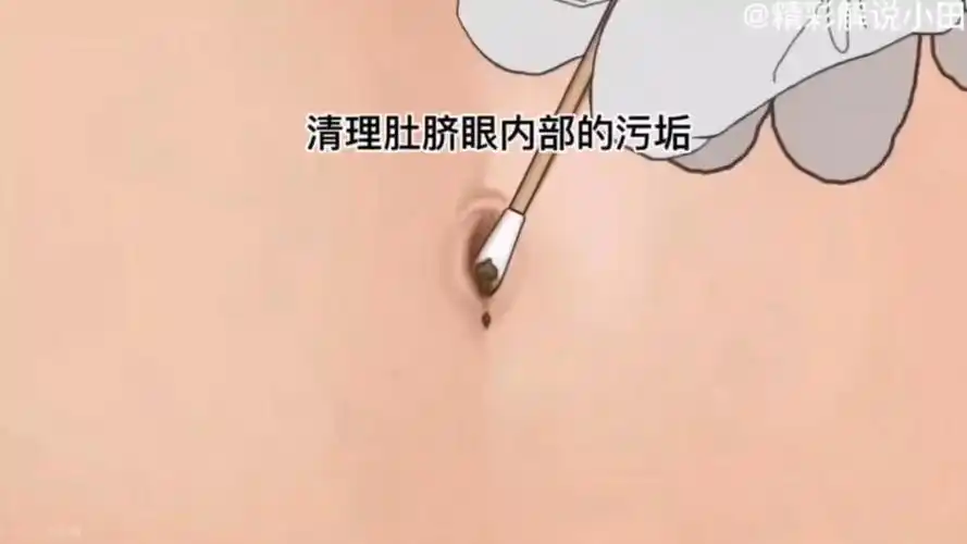 肚脐眼有灰尘怎么清理 肚脐眼脏怎么清理_百科-8s新商盟